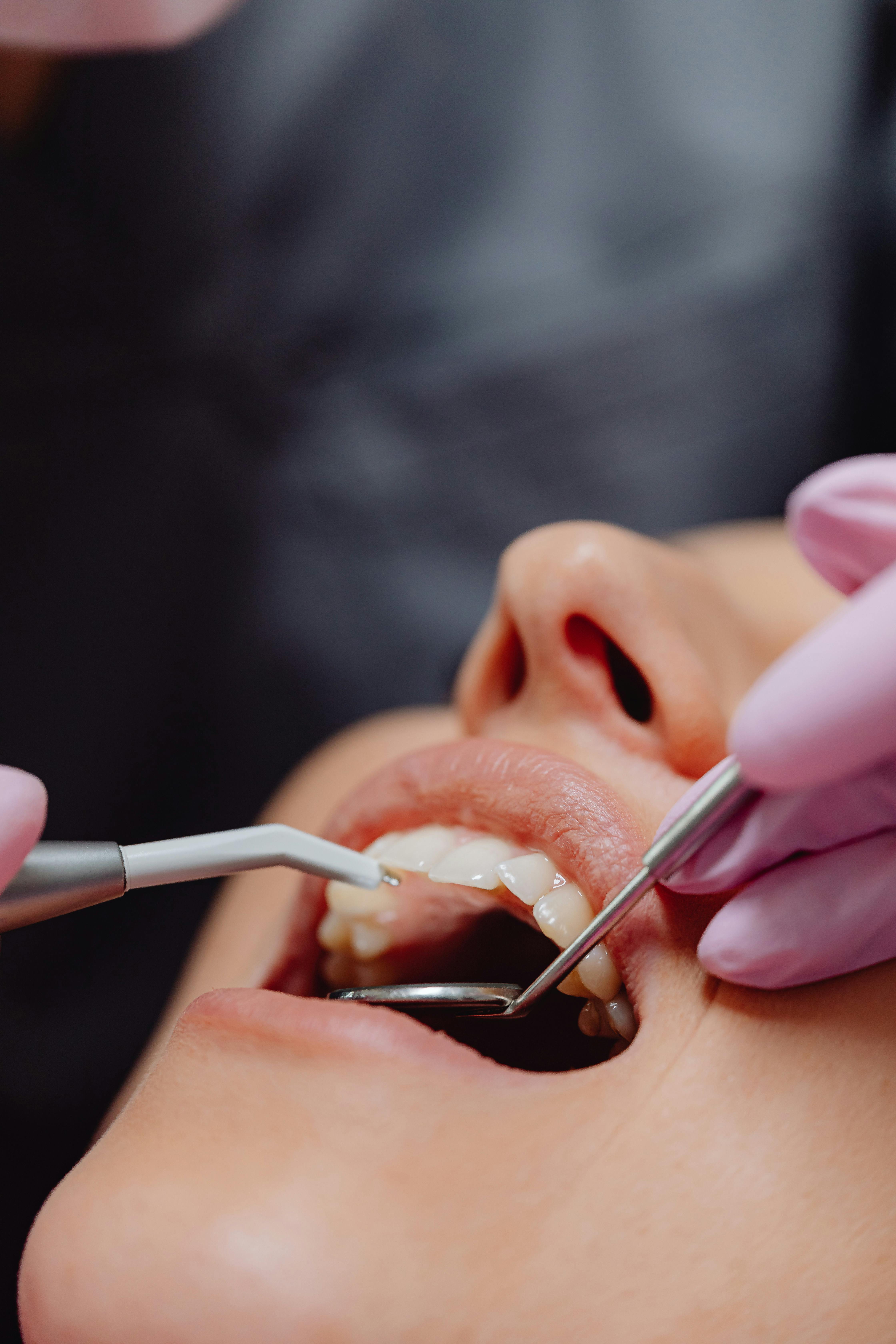 Dental Implants